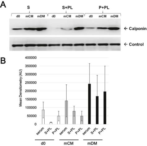 Choice Of Xenogenic Free Expansion Media Significantly Influences The