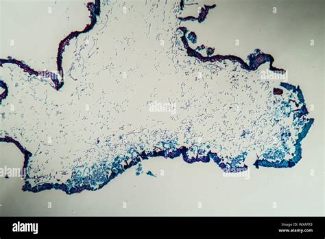 Lichen Cross Section Through The Symbiont Body 100x Stock Photo Alamy