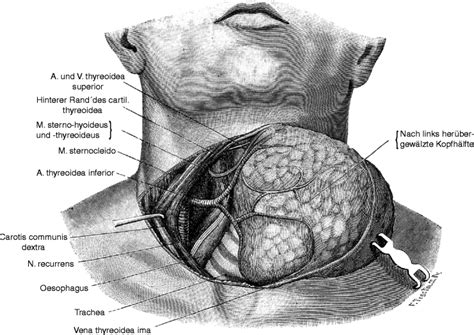 History Of Thyroid Surgery The Kocher Incision Springerlink