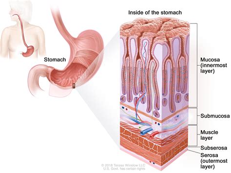 Stages of Stomach Cancer - NCI