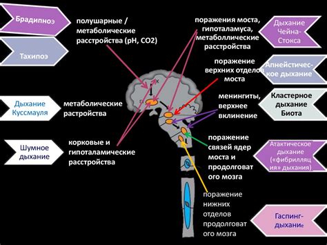 Коматозные состояния в практике невролога - презентация онлайн