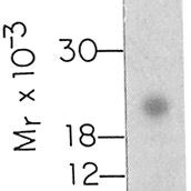 Characterization Of 251 GM CSF By SDS PAGE 2 I GM CSF Specific