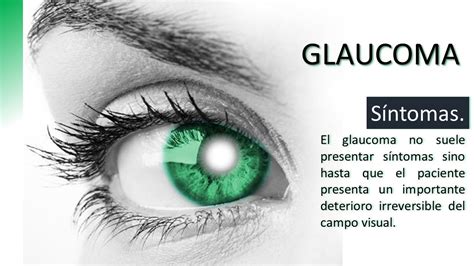 El Glaucoma Causas Y Tratamiento Oftalima Centro Oftalmológico Lima Perú