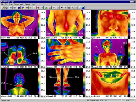 Thermreview Infrared Image Processing Software For Medical Thermal