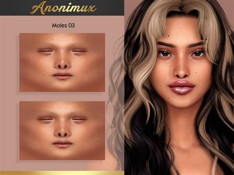 Anonimux Simmer S Moles 03 In 2023 The Sims 4 Skin Sims 4 Body Mods