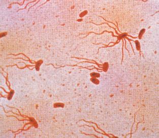 Enteric Fever Typhoid Fever Concise Medical Knowledge