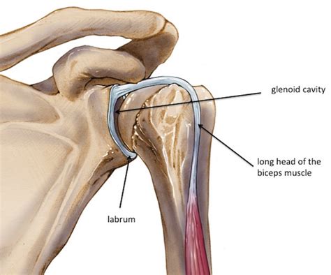 Labral Tear Slap Lesion