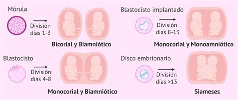 Qu Diferencia El Embarazo De Gemelos Del Embarazo De Mellizos