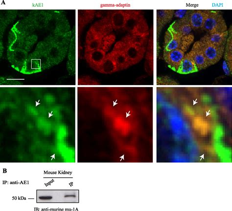 Adaptor Protein 1 Complexes Regulate Intracellular Trafficking Of The