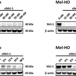 Efficient Downregulation Of Mcl 1 By Mcl 1 SiRNAs In Melanoma Cells