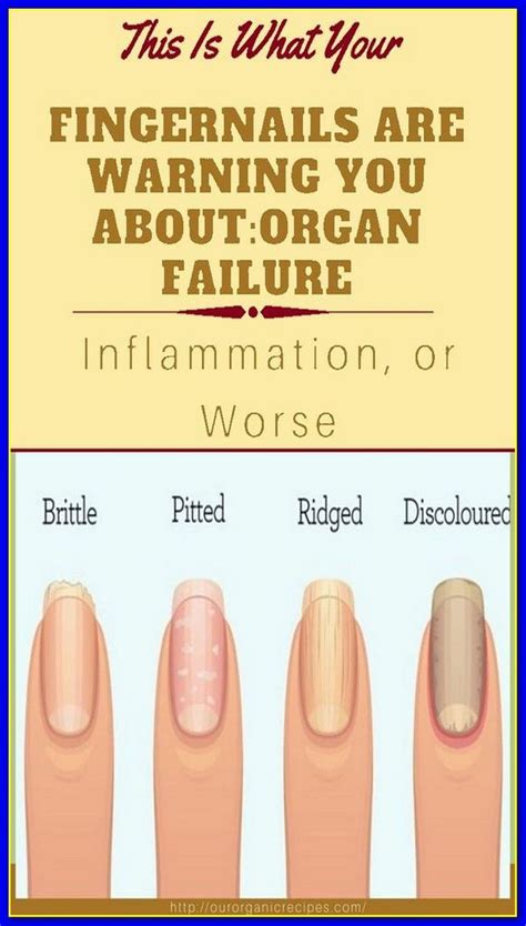 8 Important Signs Your Fingernails Can Tell About Your Health Artofit