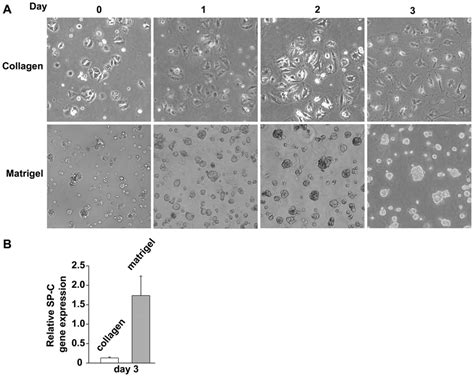 In Vitro Culture Of Adult Human Alveolar Epithelial Cells A Human