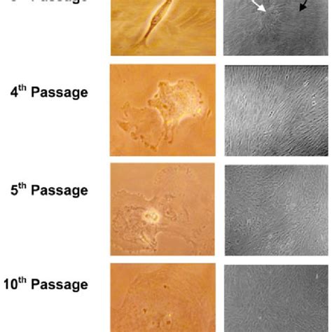 Phase Contrast Microscopy Demonstrating VSMCs Morphology In Various