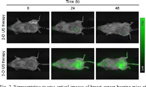 Figure From Ultrasound Image Guided Drug Delivery Using A Spherically