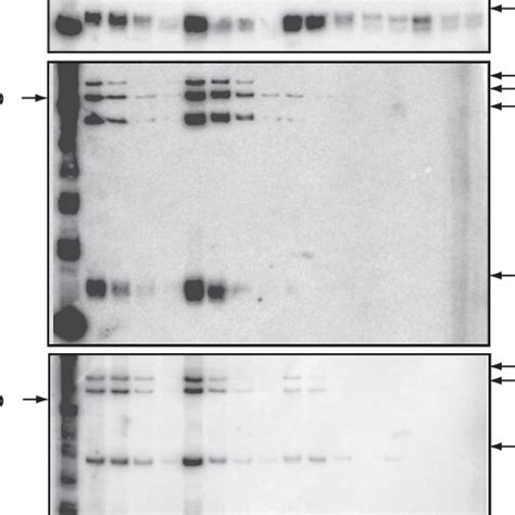 V H Dj H And V K J K Rearrangements But Not D J H Rearrangement Are