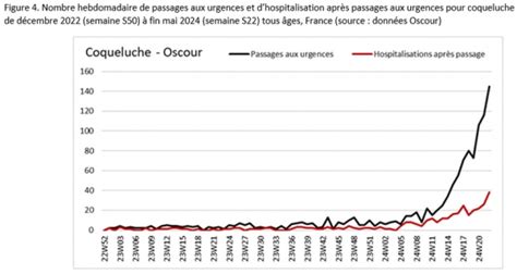 Résurgence de la coqueluche en France les mesures de prévention sont