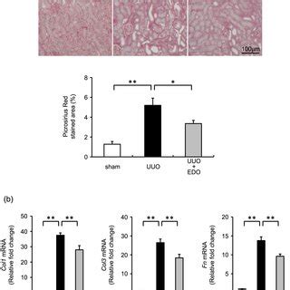 Effect Of Edoxaban On Unilateral Ureteral Obstruction UUO Induced