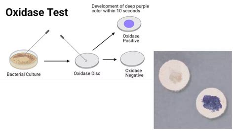 Biochemical Tests For Bacterial Identification Ppt