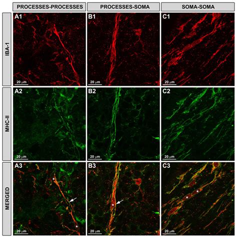 Rod Like Microglia Expressed Mhc Ii And Related To Each Other In Three