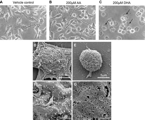 Metabolism Of Docosahexaenoic Acid Dha Induces Pyroptosis In Bv 2 Microglial Cells Springerlink