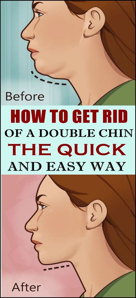 How To Get Rid Of A Double Chin The Quick And Easy Way Double Chin