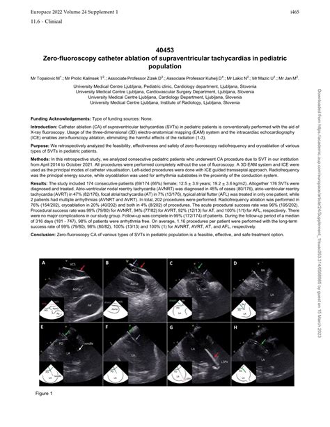 PDF Zero Fluoroscopy Catheter Ablation Of Supraventricular