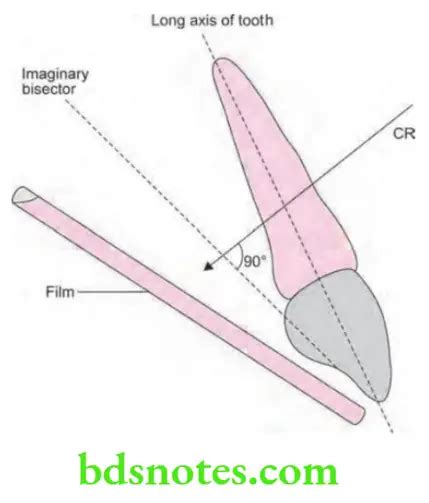 Intraoral Radiographic Techniques Question And Answers Bds Notes