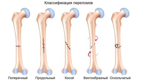 Переломы и вывихи ⚕️ Лечение в Днепре ⋮ MEDICAL PLAZA