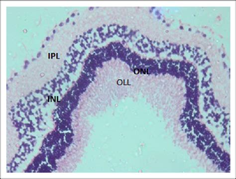 Photomicrograph Of Retinal Tissue After Iv Mvs Injection Showing