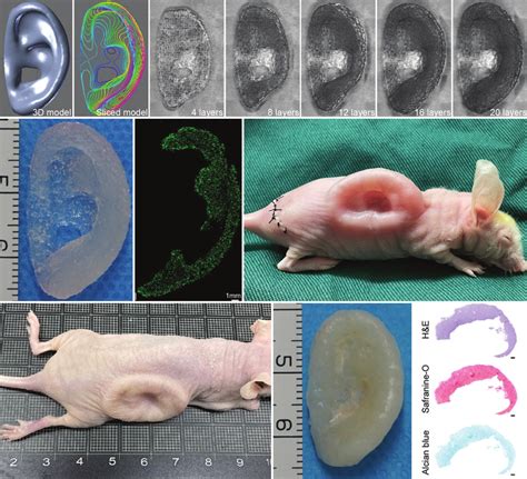 D Bioprinting Of Ear Shaped Cartilage Using Bacterial Nanocellulose