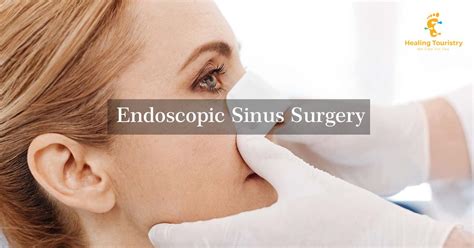 Endoscopic Sinus Surgery Sinus Surgery Sinusitis Surgery