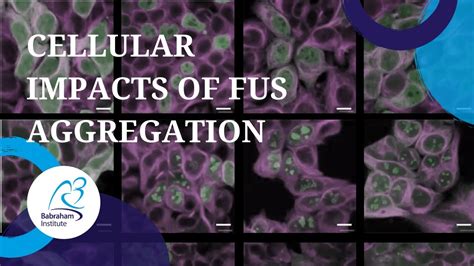 SEMINAR FUS Overexpression Leads To Cellular Homeostasis Perturbations