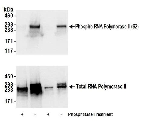 Anti Polr2a Rna Polymerase Ii Antibody Rabbit Anti Human Lsbio