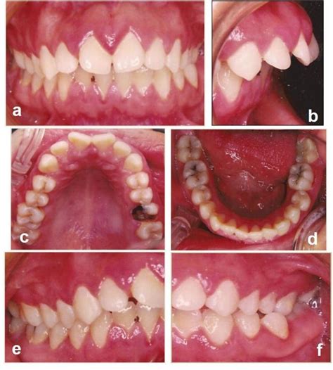 Mis casos clínicos en Odontología PDF Download Available