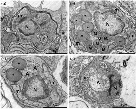 Ultrathin Sections Of L Amazonensis Intracellular Control Amastigotes