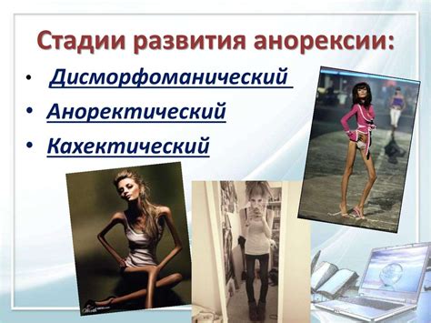 Анорексия-проблема нашего века - online presentation