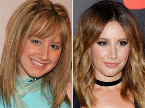 Nose Job Before And After Celebrities