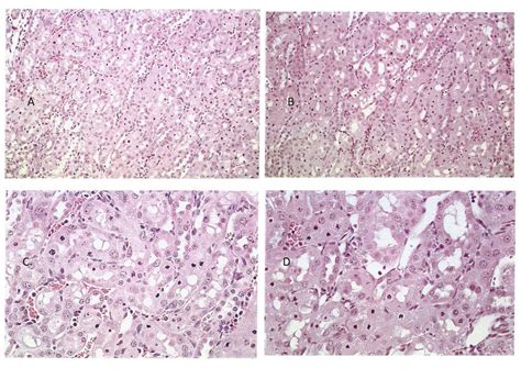 Renal Apoptosis In The Mycotoxicology Of Penicillium Polonicum And