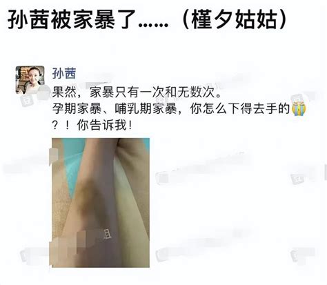 “槿汐姑姑”孙茜疑似被家暴！孕期哺乳期遭殴打，膝盖上大片淤青甄嬛传孙茜蔡远航新浪新闻