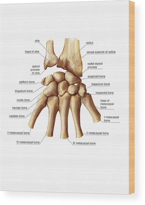 Wrist And Metacarpus Bones Wood Print by Asklepios Medical Atlas | Pixels