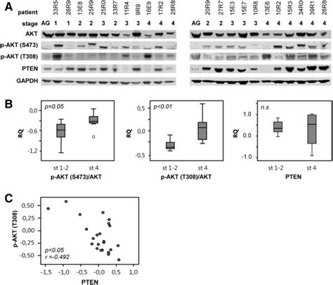 Phosphorylated Akt And Correlation To Pten A Western Blot Of Primary