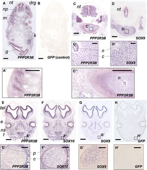 PPP2R3B Is Expressed At Sites Of Chondrogenesis In Normal Human