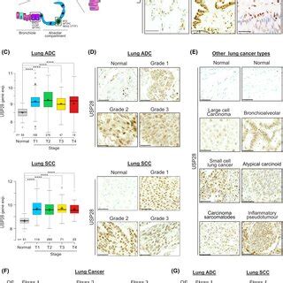 USP28 Is Expressed In Human Cell Of Origin For NSCLC And Upregulated