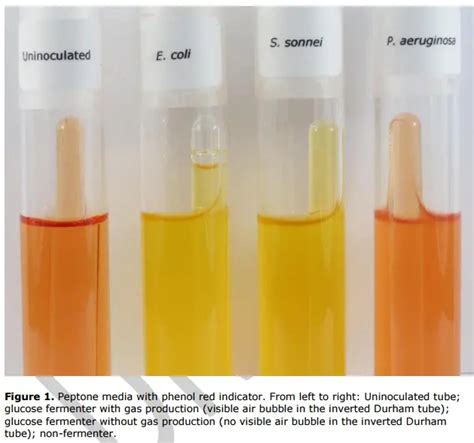 Carbohydrate Fermentation Test Uses Principle Procedure And Results