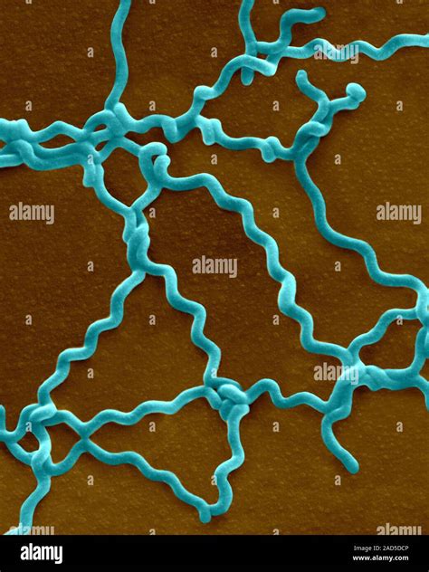 Coloured Scanning Electron Micrograph Sem Of Leptospira Interrogans