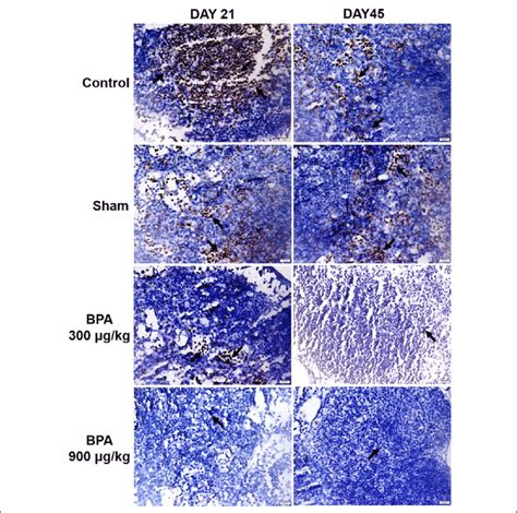 The Immunohistochemical Distribution Of Cd3 In The Lymph Node Samples Download Scientific