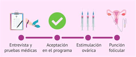 ¿cómo Se Hace La Donación De óvulos Paso A Paso