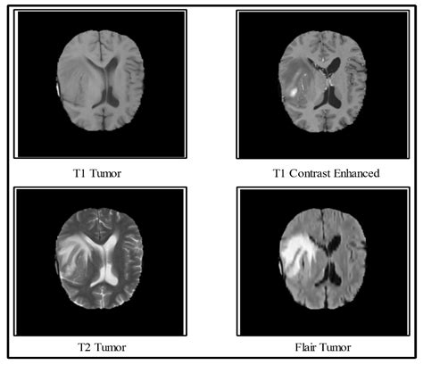 Diagnostics Free Full Text Multimodal Brain Tumor Classification