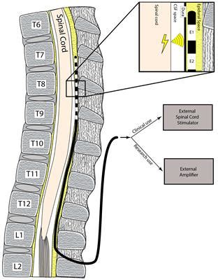 Frontiers Epidural Spinal Electrogram Provides Direct Spinal