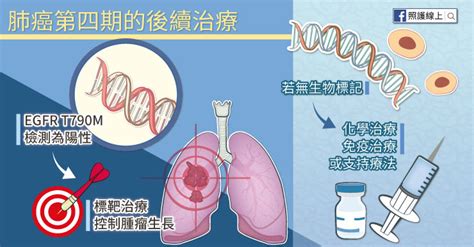 肺癌第四期怎麼辦？醫師圖文解說